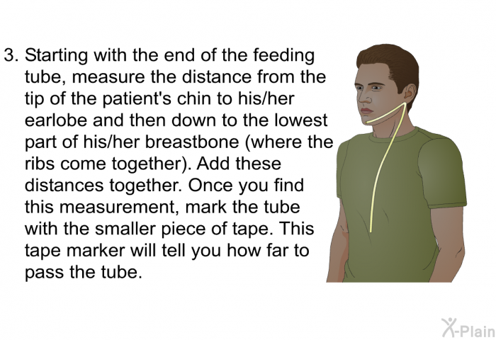 Starting with the end of the feeding tube, measure the distance from the tip of the patient's chin to his/her earlobe and then down to the lowest part of his/her breastbone (where the ribs come together). Add these distances together. Once you find this measurement, mark the tube with the smaller piece of tape. This tape marker will tell you how far to pass the tube.