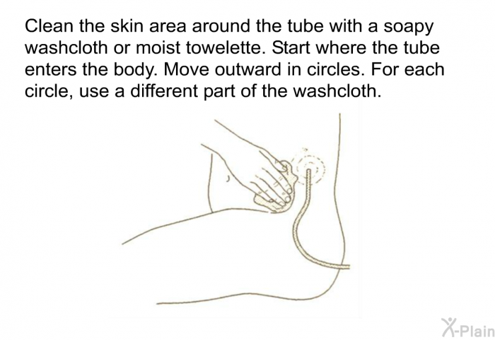 Clean the skin area around the tube with a soapy washcloth or moist towelette. Start where the tube enters the body. Move outward in circles. For each circle, use a different part of the washcloth.