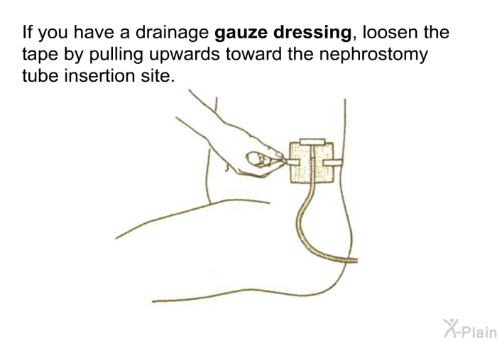 If you have a drainage <B>gauze dressing</B>, loosen the tape by pulling upwards toward the nephrostomy tube insertion site.