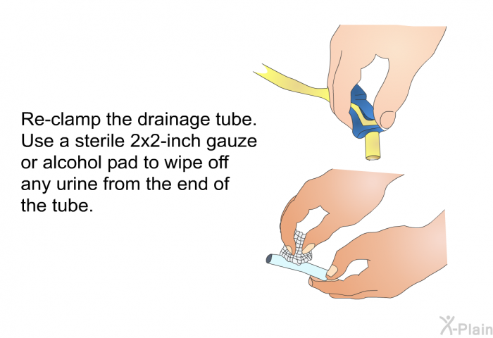 Re-clamp the drainage tube. Use a sterile 2x2-inch gauze or alcohol pad to wipe off any urine from the end of the tube.