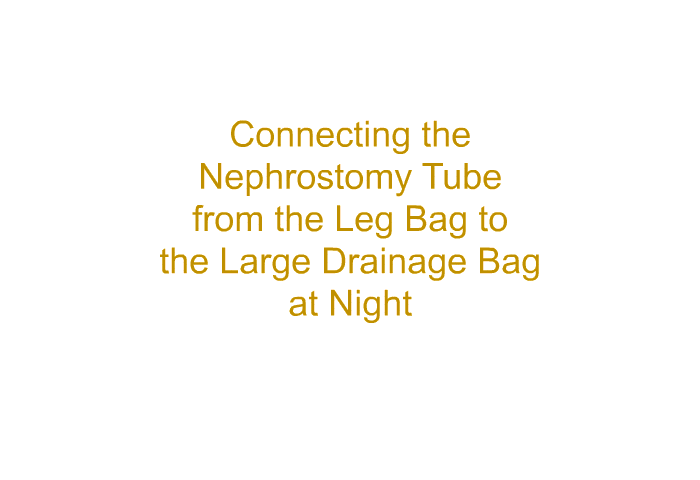Connecting the Nephrostomy Tube from the Leg Bag to the Large Drainage Bag at Night