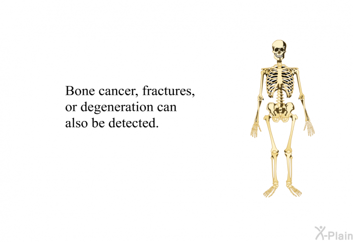 Bone cancer, fractures, or degeneration can also be detected.