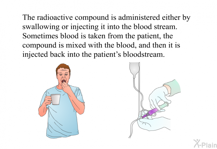 The radioactive compound is administered either by swallowing or injecting it into the blood stream. Sometimes blood is taken from the patient, the compound is mixed with the blood, and then it is injected back into the patient's bloodstream.