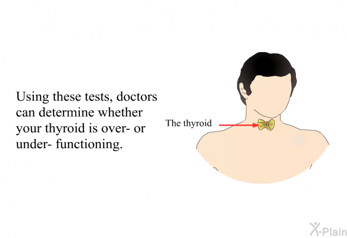 Using these tests, doctors can determine whether your thyroid is over- or under- functioning.