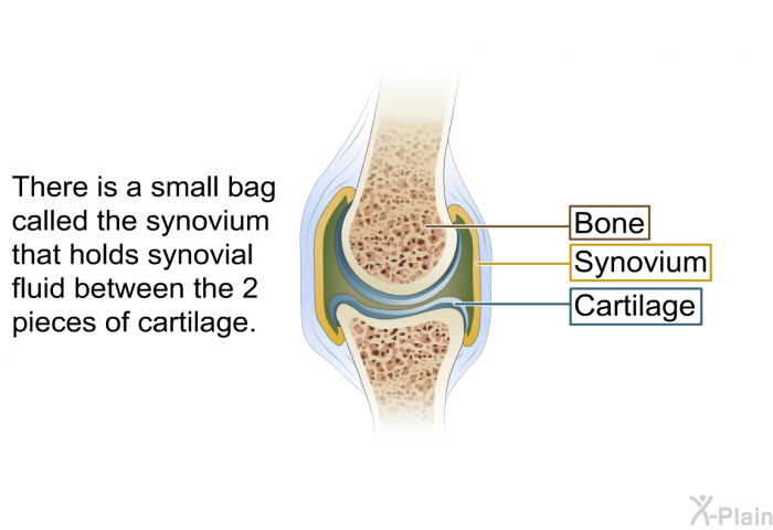 There is a small bag called the <I>synovium</I> that holds synovial fluid between the 2 pieces of cartilage.