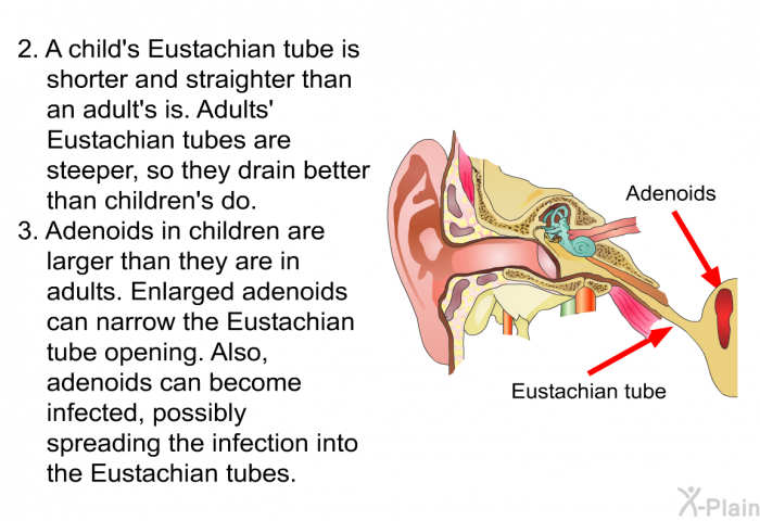 A child's Eustachian tube is shorter and straighter than an adult's is. Adults' Eustachian tubes are steeper, so they drain better than children's do. Adenoids in children are larger than they are in adults. Enlarged adenoids can narrow the Eustachian tube opening. Also, adenoids can become infected, possibly spreading the infection into the Eustachian tubes.