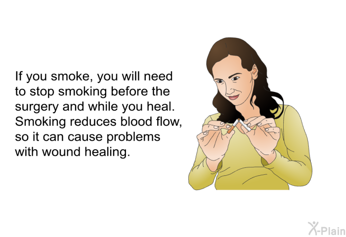 If you smoke, you will need to stop smoking before the surgery and while you heal. Smoking reduces blood flow, so it can cause problems with wound healing.