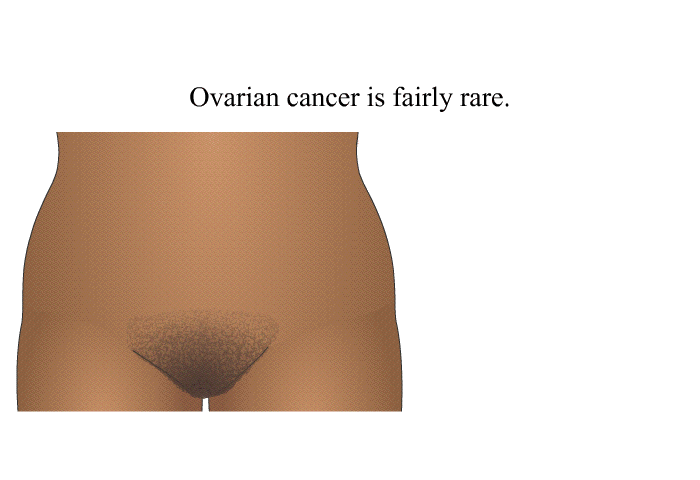 Ovarian cancer is fairly rare.
