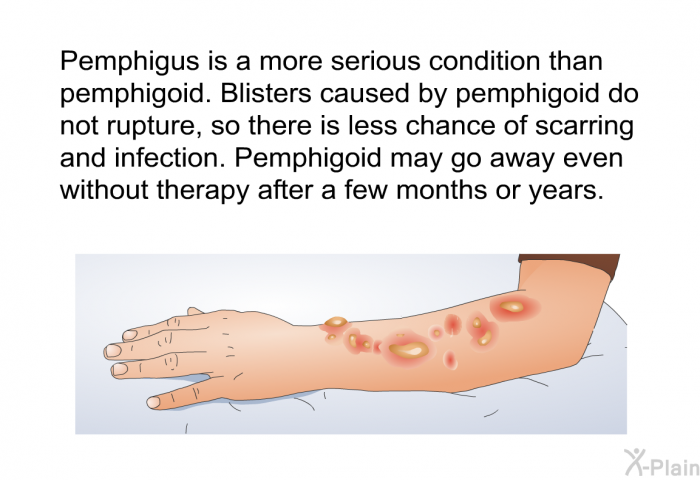 Pemphigus is a more serious condition than pemphigoid. Blisters caused by pemphigoid do not rupture, so there is less chance of scarring and infection. Pemphigoid may go away even without therapy after a few months or years.