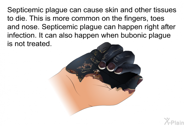 Septicemic plague can cause skin and other tissues to die. This is more common on the fingers, toes and nose. Septicemic plague can happen right after infection. It can also happen when bubonic plague is not treated.