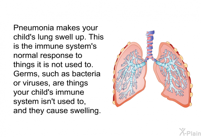 Pneumonia makes your child's lung swell up. This is the immune system's normal response to things it is not used to. Germs, such as bacteria or viruses, are things your child's immune system isn't used to, and they cause swelling.