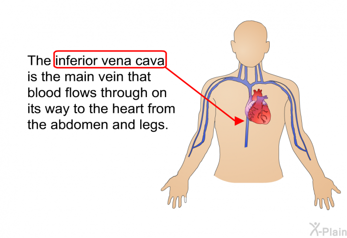 The inferior vena cava is the main vein that blood flows through on its way to the heart from the abdomen and legs.