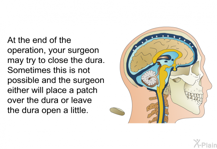 At the end of the operation, your surgeon may try to close the dura. Sometimes this is not possible and the surgeon either will place a patch over the dura or leave the dura open a little.