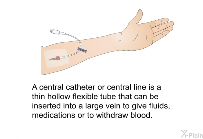 A central catheter or central line is a thin hollow flexible tube that can be inserted into a large vein to give fluids, medications or to withdraw blood.