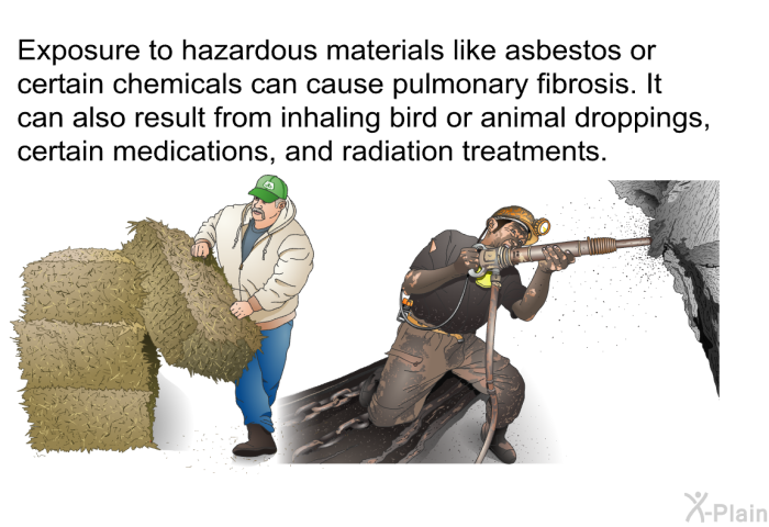 Exposure to hazardous materials like asbestos or certain chemicals can cause pulmonary fibrosis. It can also result from inhaling bird or animal droppings, certain medications, and radiation treatments.