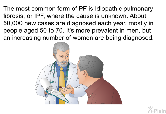 The most common form of PF is Idiopathic pulmonary fibrosis, or IPF, where the cause is unknown. About 50,000 new cases are diagnosed each year, mostly in people aged 50 to 70. It's more prevalent in men, but an increasing number of women are being diagnosed.