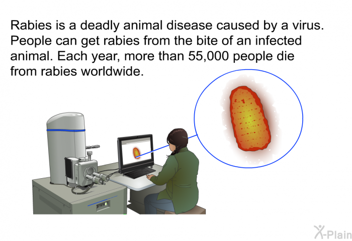 Rabies is a deadly animal disease caused by a virus. People can get rabies from the bite of an infected animal. Each year, more than 55,000 people die from rabies worldwide.