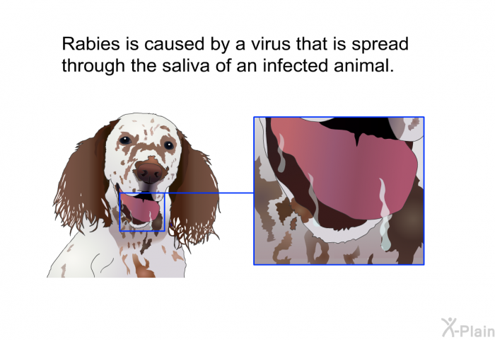 Rabies is caused by a virus that is spread through the saliva of an infected animal.
