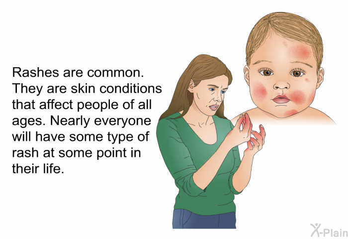 Rashes are common. They are skin conditions that affect people of all ages. Nearly everyone will have some type of rash at some point in their life.