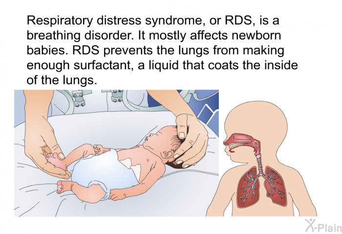 Respiratory distress syndrome, or RDS, is a breathing disorder. It mostly affects newborn babies. RDS prevents the lungs from making enough surfactant, a liquid that coats the inside of the lungs.