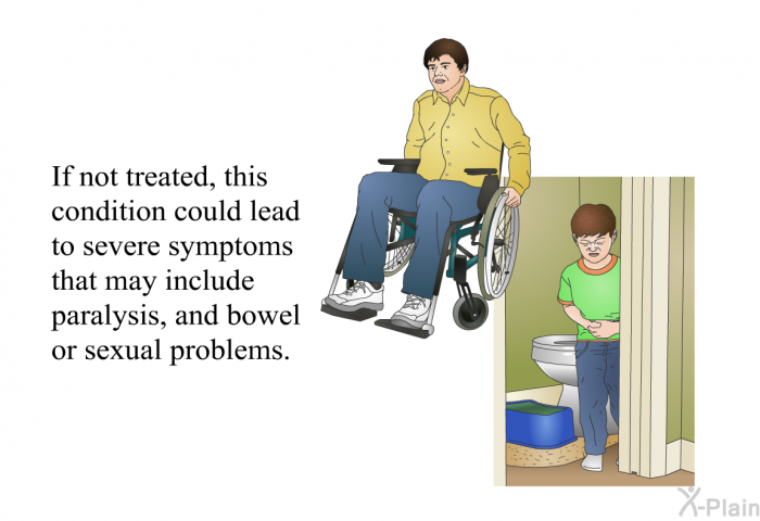 If not treated, this condition could lead to severe symptoms that may include paralysis, and bowel or sexual problems.