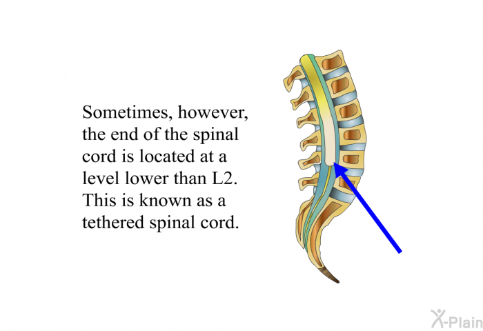 Sometimes, however, the end of the spinal cord is located at a level lower than L2. This is known as a tethered spinal cord.