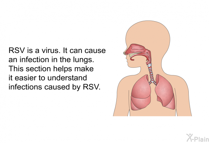 RSV is a virus. It can cause an infection in the lungs. This section helps make it easier to understand infections caused by RSV.