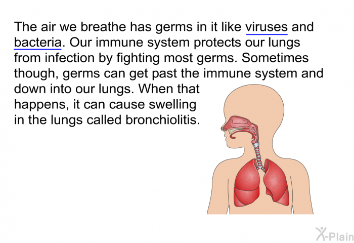 The air we breathe has germs in it like viruses and bacteria. Our immune system protects our lungs from infection by fighting most germs. Sometimes though, germs can get past the immune system and down into our lungs. When that happens, it can cause swelling in the lungs called bronchiolitis.