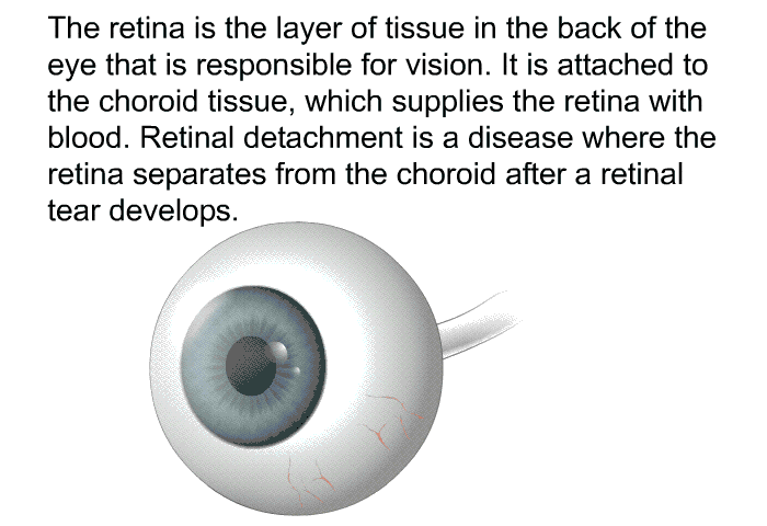 The retina is the layer of tissue in the back of the eye that is responsible for vision. It is attached to the choroid tissue, which supplies the retina with blood. Retinal detachment is a disease where the retina separates from the choroid after a retinal tear develops.
