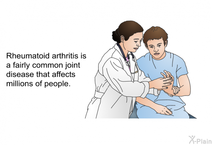 Rheumatoid arthritis is a fairly common joint disease that affects millions of people.