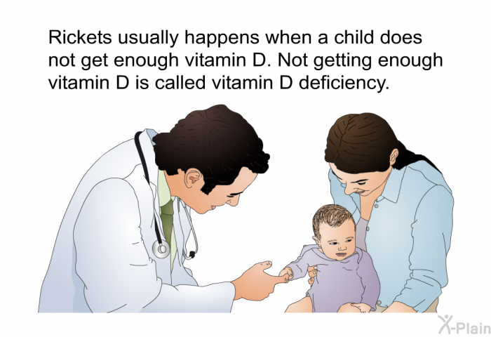 Rickets usually happens when a child does not get enough vitamin D. Not getting enough vitamin D is called vitamin D deficiency.