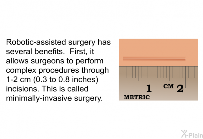 Robotic-assisted surgery has several benefits. First, it allows surgeons to perform complex procedures through 1-2 cm (0.3 to 0.8 inches) incisions. This is called minimally-invasive surgery.