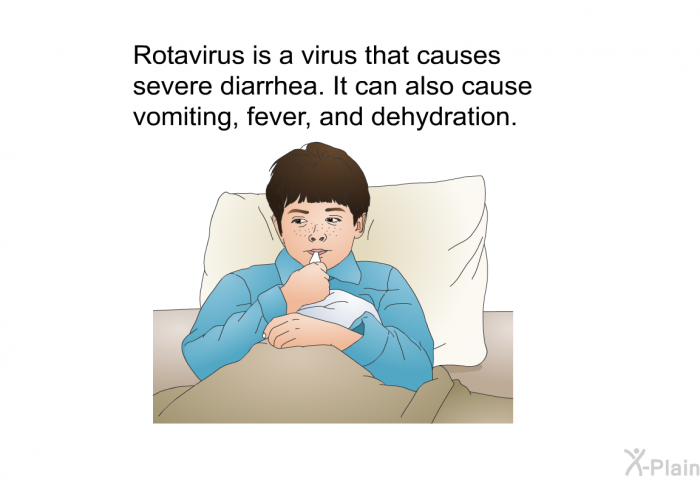 Rotavirus is a virus that causes severe diarrhea. It can also cause vomiting, fever, and dehydration.