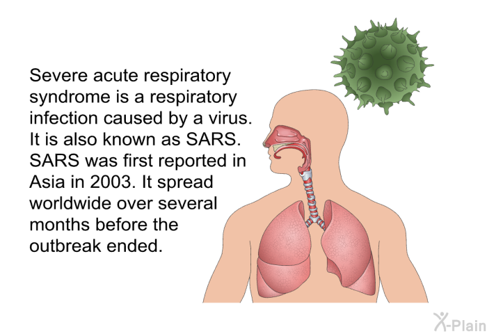 Severe acute respiratory syndrome is a respiratory infection caused by a virus. It is also known as SARS. SARS was first reported in Asia in 2003. It spread worldwide over several months before the outbreak ended.