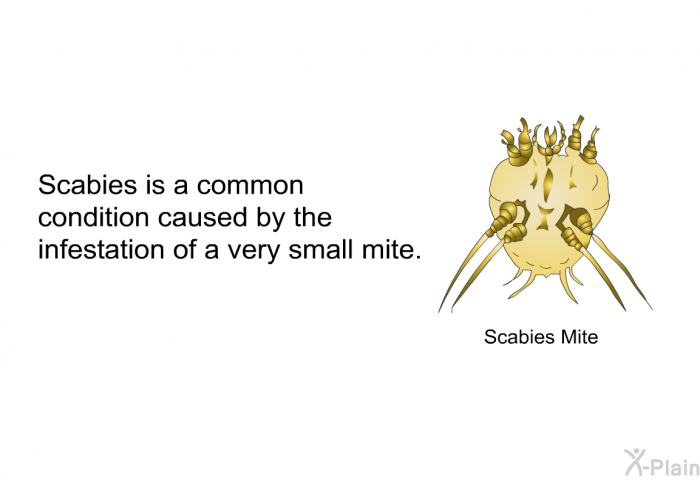 Scabies is a common condition caused by the infestation of a very small mite<I>.</I>