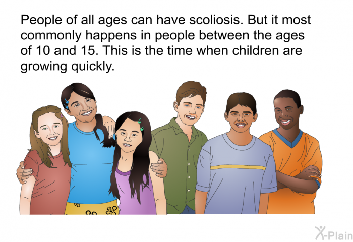 People of all ages can have scoliosis. But it most commonly happens in people between the ages of 10 and 15. This is the time when children are growing quickly.