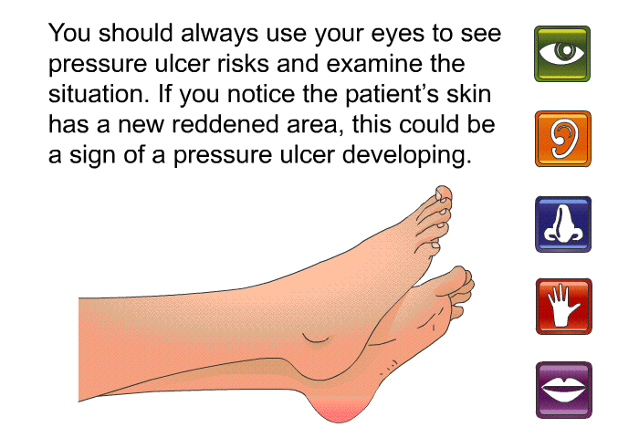 You should always use your eyes to see pressure ulcer risks and examine the situation. If you notice the patient's skin has a new reddened area, this could be a sign of a pressure ulcer developing.