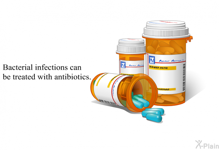 Bacterial infections can be treated with antibiotics.