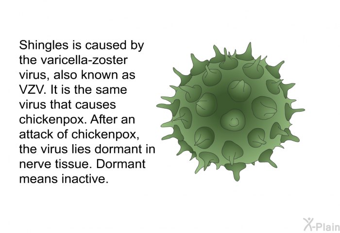 Shingles is caused by the varicella-zoster virus, also known as VZV. It is the same virus that causes chickenpox. After an attack of chickenpox, the virus lies dormant in nerve tissue. Dormant means inactive.