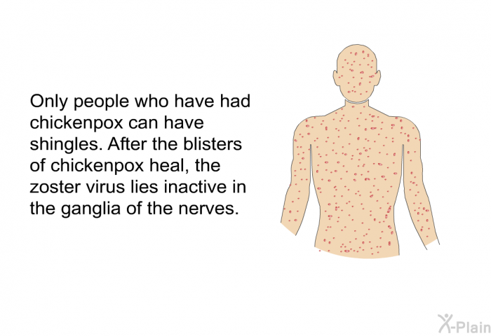 Only people who have had chickenpox can have shingles. After the blisters of chickenpox heal, the zoster virus lies inactive in the ganglia of the nerves.
