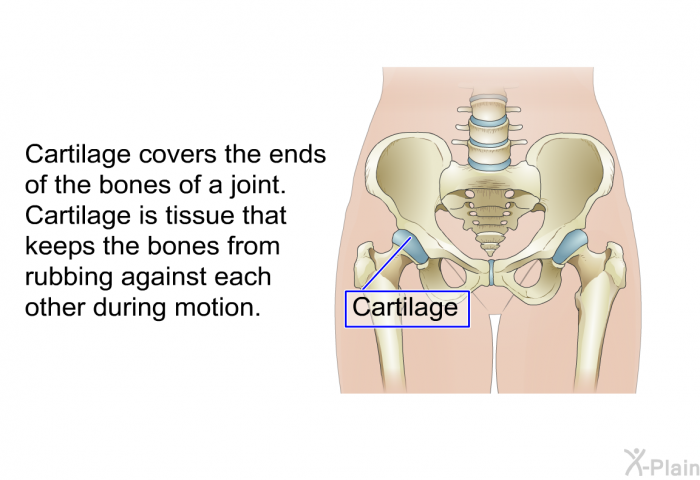 Cartilage covers the ends of the bones of a joint. Cartilage is tissue that keeps the bones from rubbing against each other during motion.