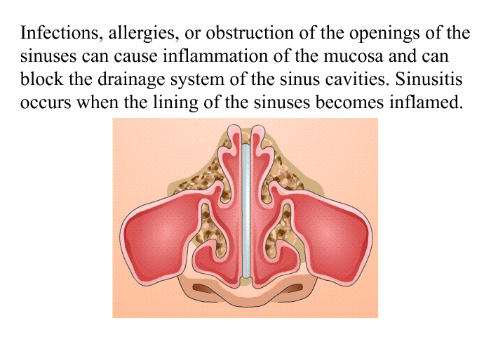 Infections, allergies, or obstruction of the openings of the sinuses can cause inflammation of the mucosa and can block the drainage system of the sinus cavities. Sinusitis occurs when the lining of the sinuses becomes inflamed.