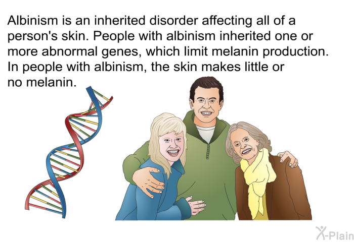 Albinism is an inherited disorder affecting all of a person's skin. People with albinism inherited one or more abnormal genes, which limit melanin production. In people with albinism, the skin makes little or no melanin.