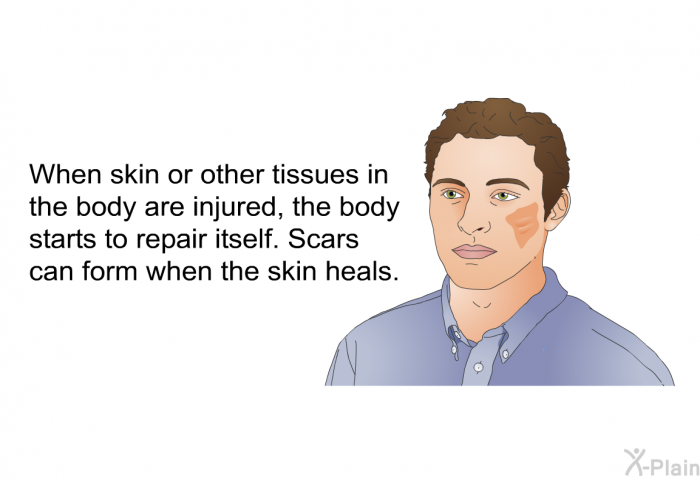 When skin or other tissues in the body are injured, the body starts to repair itself. Scars can form when the skin heals.