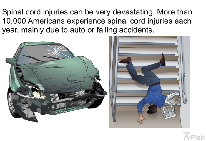 Spinal cord injuries can be very devastating. More than 10,000 Americans experience spinal cord injuries each year, mainly due to auto or falling accidents.
