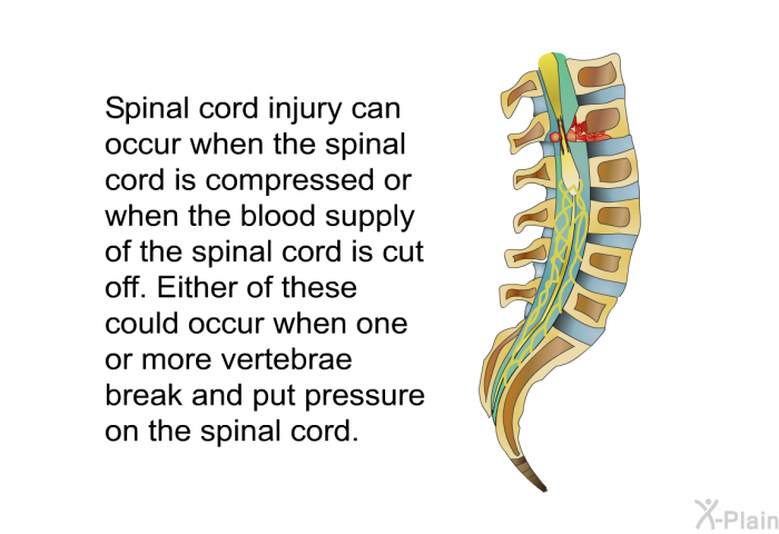 Spinal cord injury can occur when the spinal cord is compressed or when the blood supply of the spinal cord is cut off. Either of these could occur when one or more vertebrae break and put pressure on the spinal cord.