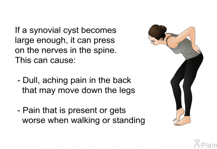If a synovial cyst becomes large enough, it can press on the nerves in the spine. This can cause:  Dull, aching pain in the back that may move down the legs Pain that is present or gets worse when walking or standing