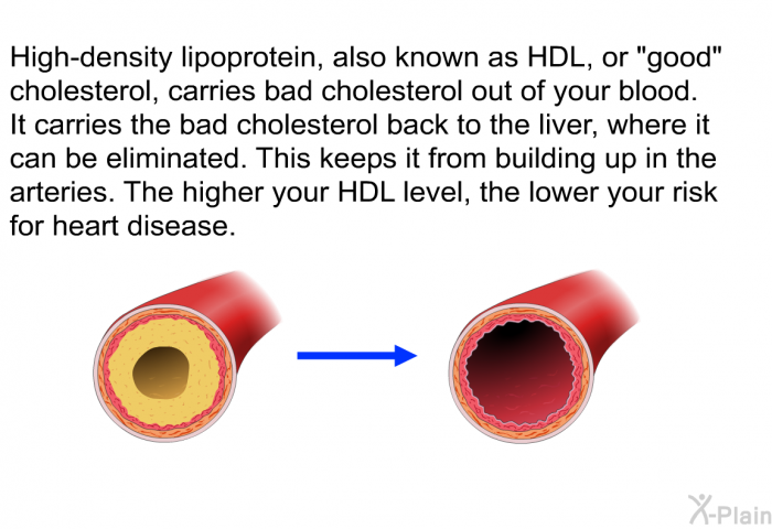 High-density lipoprotein, also known as HDL, or "good" cholesterol, carries bad cholesterol out of your blood. It carries the bad cholesterol back to the liver, where it can be eliminated. This keeps it from building up in the arteries. The higher your HDL level, the lower your risk for heart disease.