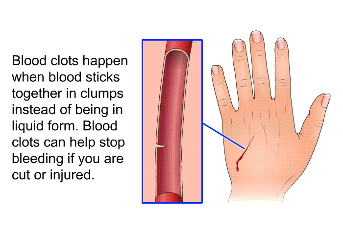 Blood clots happen when blood sticks together in clumps instead of being in liquid form. Blood clots can help stop bleeding if you are cut or injured.
