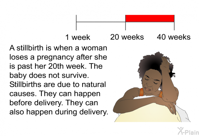 A stillbirth is when a woman loses a pregnancy after she is past her 20th week. The baby does not survive. Stillbirths are due to natural causes. They can happen before delivery. They can also happen during delivery.